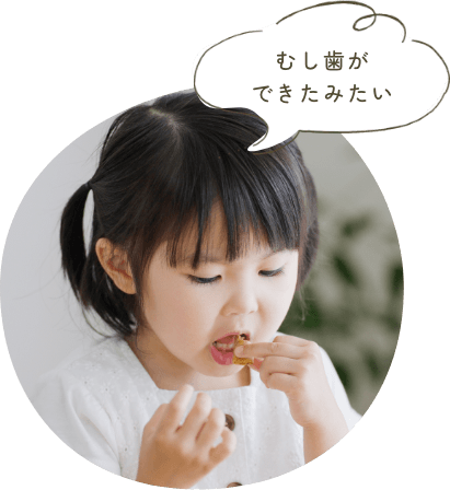 むし歯ができたみたい
