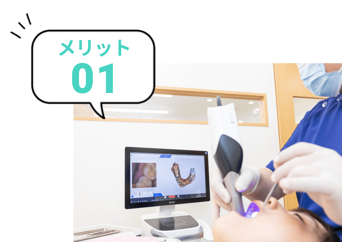 口腔内スキャンしている写真