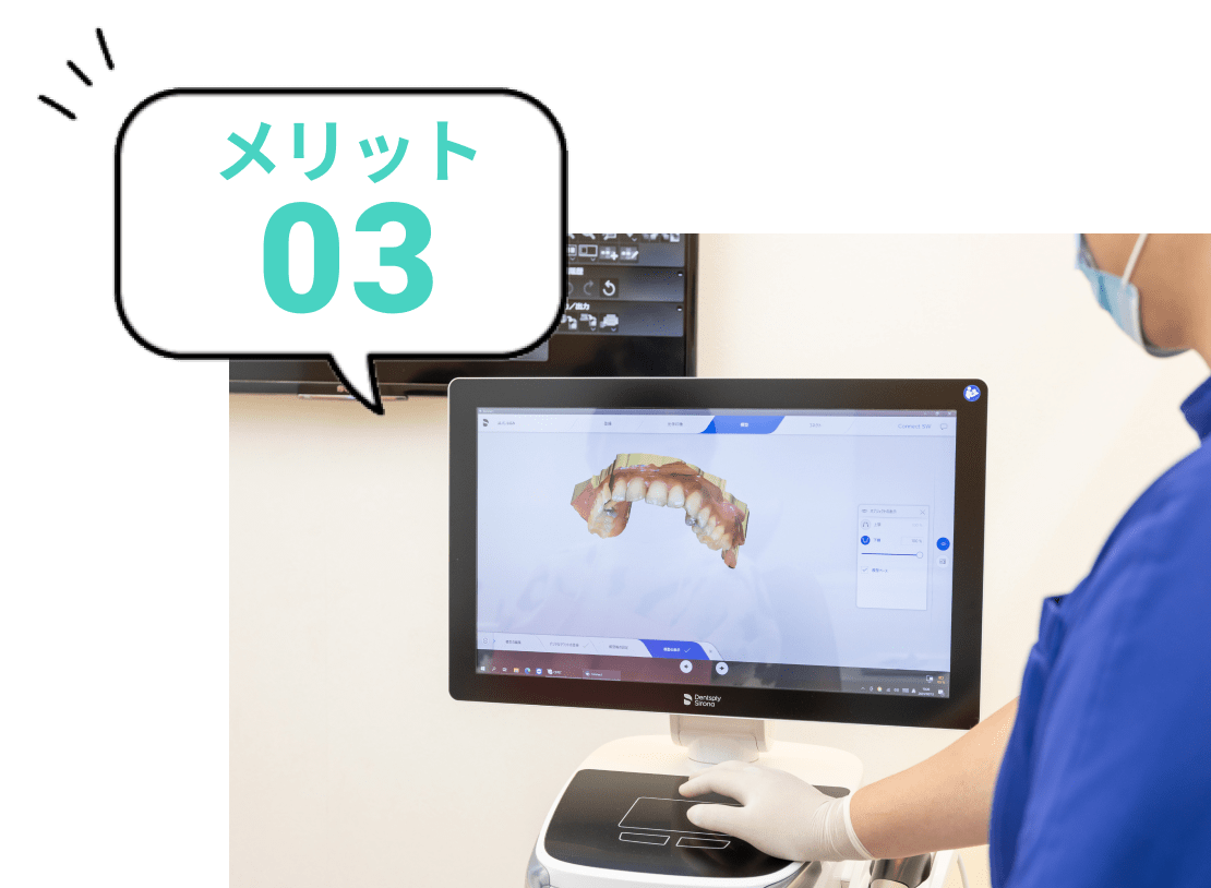 口腔内スキャンをチェックしている写真